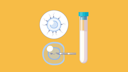 Best IVF Specialist In Hyderabad