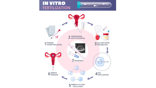 Top IVF Treatment Center In Hyderabad